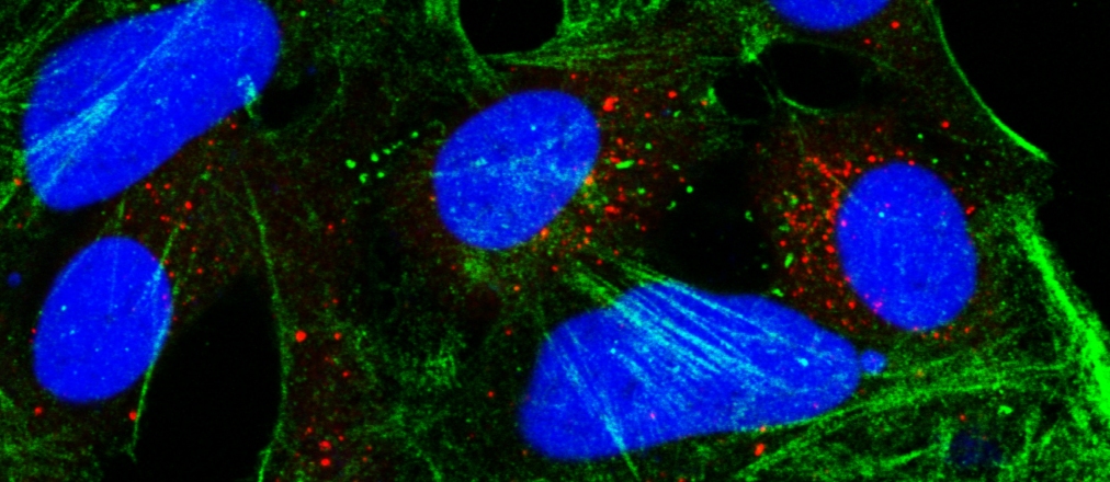 confocal3cropped.jpg