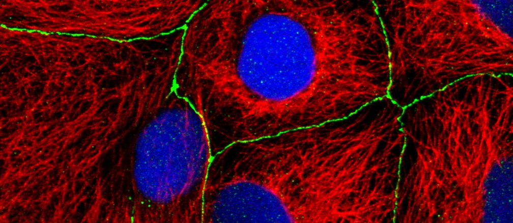 confocal6croppet.jpg