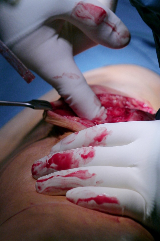 Operasjon.jpg (Bredde: 560px) Operasjon.jpg (Bredde: 560px)