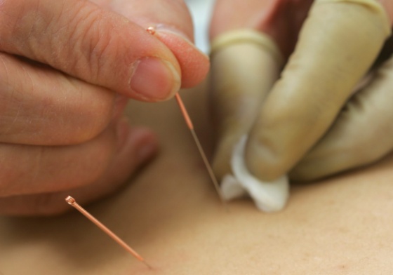 akupunktur red-72.jpg (Bredde: 560px)