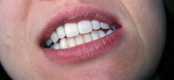 tenner.jpg (Bredde: 560px)