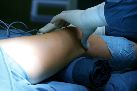 kneskade.jpg (Bredde: 560px)