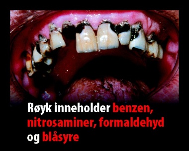 tannråte, røyk.jpg (Studiekatalog (380px))