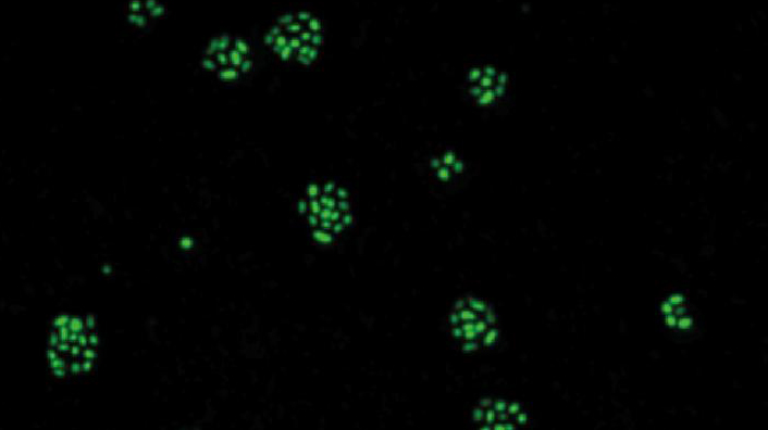 Bildet viser celler av Methylocapsa gorgona som vokser på luft, liggende på et filter. Bildet er tatt 26 dager etter at enkeltceller ble lagt på filteret, og man kan slik se at de fleste cellene i løpet av denne tiden er blitt til mellom cirka 10–15 nye celler som danner små kolonier, mens noen ikke har delt seg i det hele tatt. 