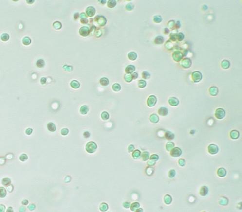 alger sett i mikroskop