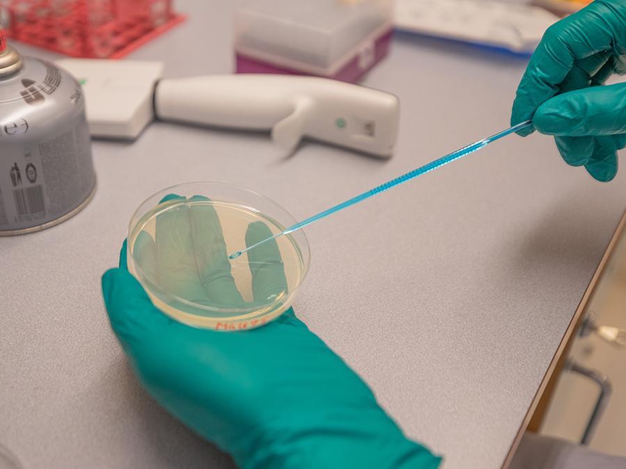 Forskerne i studien har undersøkt over 3200 isolater av E. coli som er samlet inn i Norge