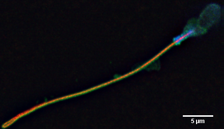 mikroskopbilete av ei sædcelle på svart bakgrunn.