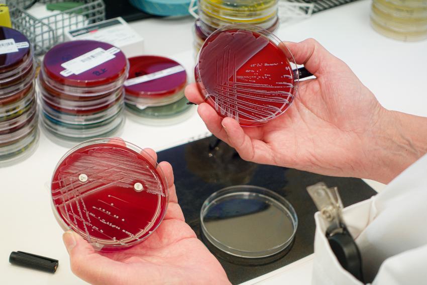Laboratorieskåler med bakterier