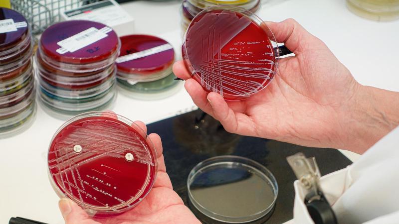 Someone holding red petri dishes.