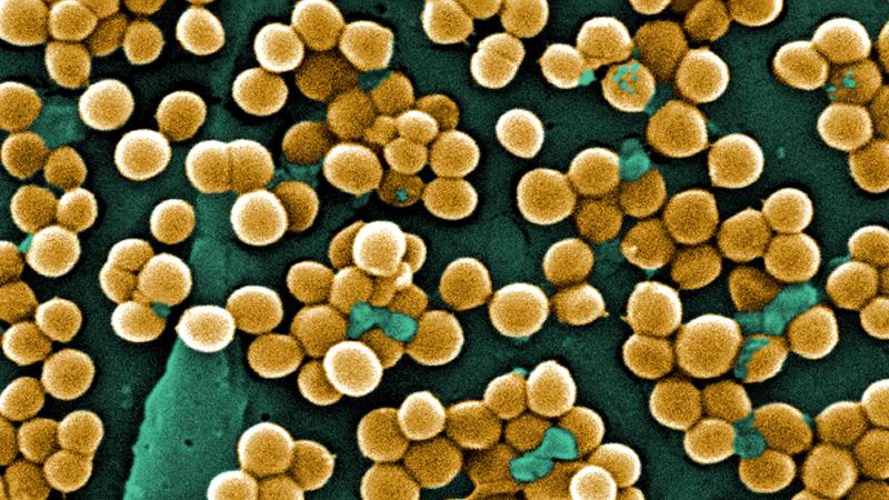a microscopic image of mrsa, that looks like lots of yellow fluffy balls