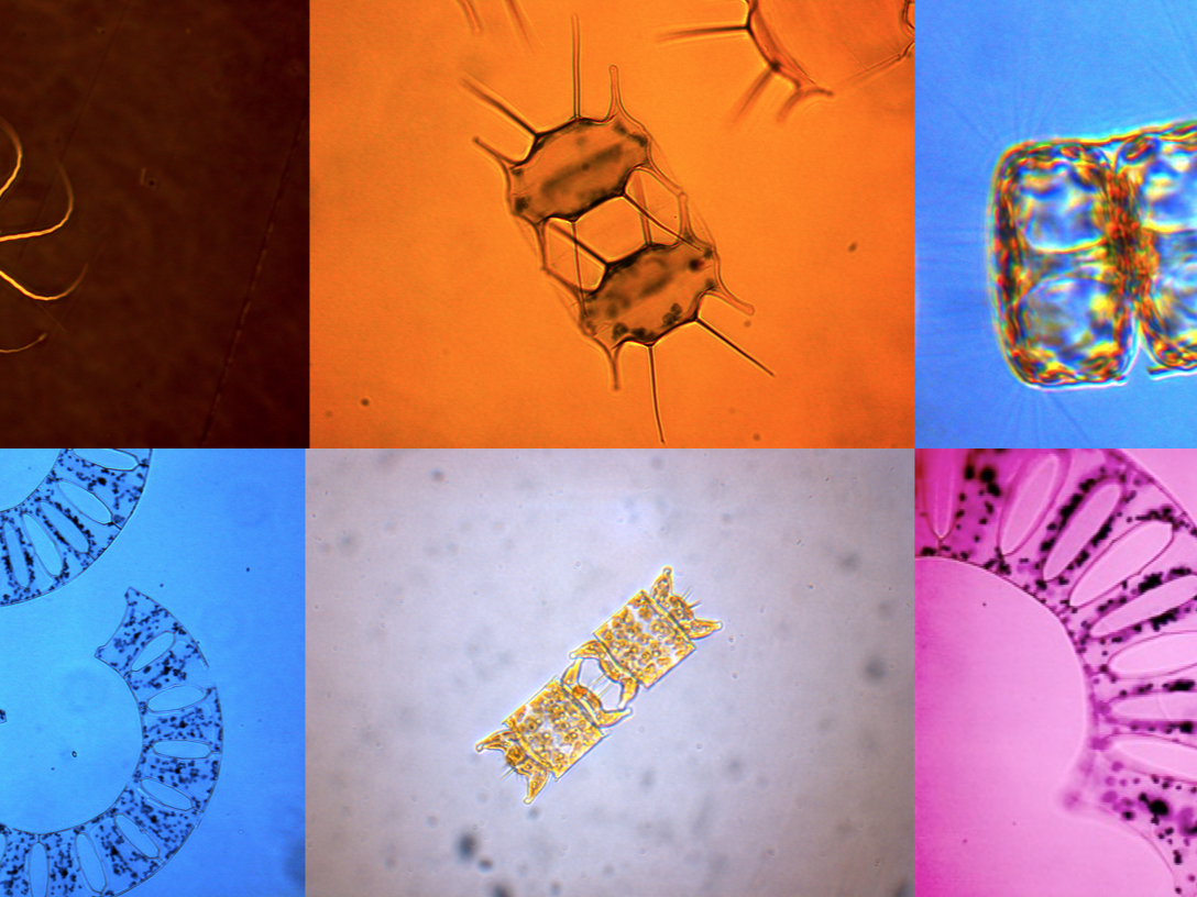 alger sett i mikroskop