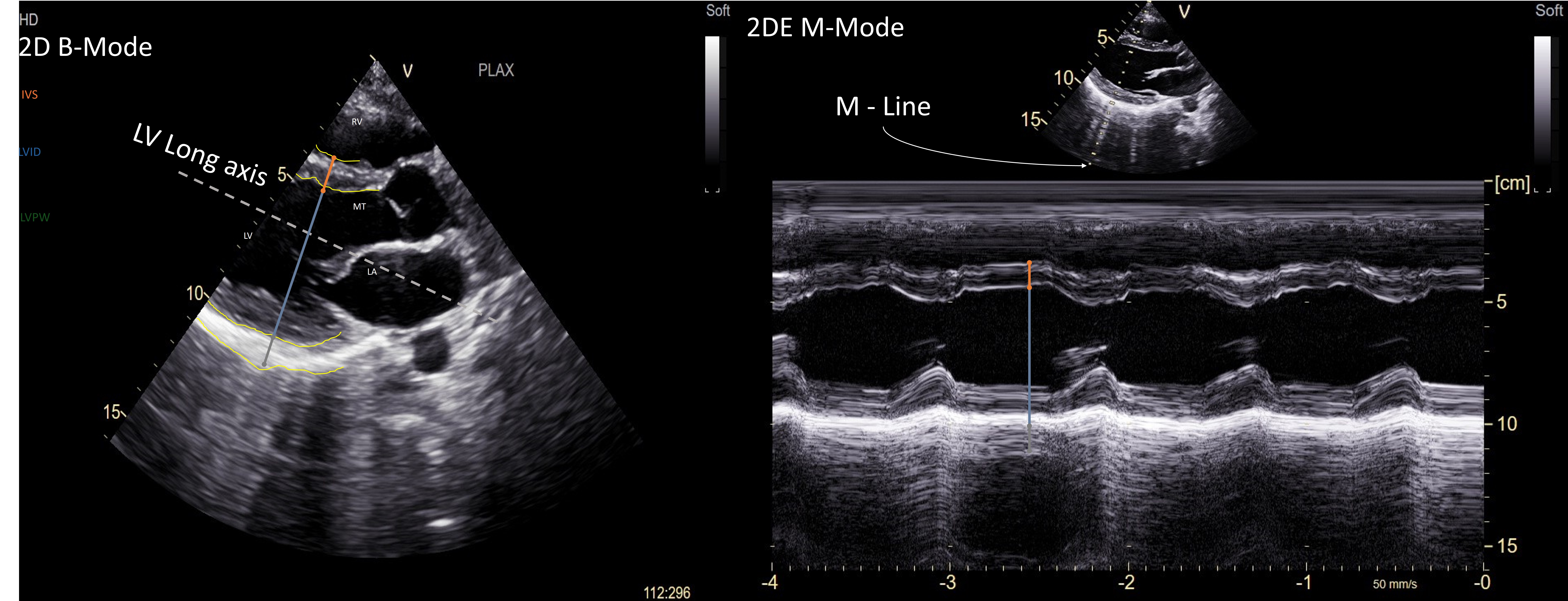 Ultralydbilder av hjertet